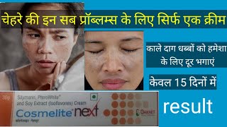 चेहरे के काले दाग धब्बों के लिए बेस्ट क्रीमcosmelite next cream review usesdosageside effects [upl. by Clayton23]