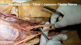 Tibial nerve Common Fibular Nerve amp Plantar nerve  Real Time Cadaveric Anatomy [upl. by Maurey]