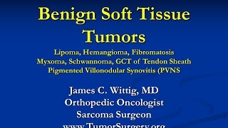 Orthopedic Oncology and Pathology Course  Benign Soft Tissue Tumors Lipoma etc  Lecture 9 [upl. by Akcira]