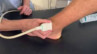 Lateral ankle ATFL ligament  ultrasound demonstration [upl. by Nari]