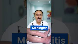 How to recognise meningitis shorts ytshorts Dr Jayanti Gurumukhani [upl. by Duester]