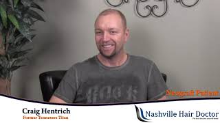 Former Titans NFL Football player Craig Hentrich about his hair transplant at Nashville Hair Doctor [upl. by Lezned297]