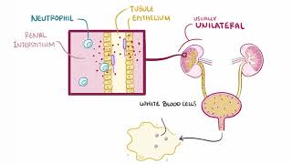 Acute Pyelonephritis  Renal Pathology  Osmosis [upl. by Durant]