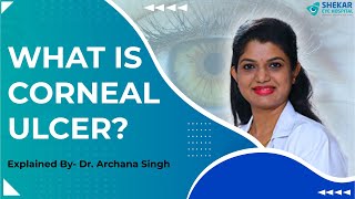 What is a Corneal Ulcer  Symptoms Causes Diagnosis amp Treatment  Shekar Eye Hospital [upl. by Millicent]