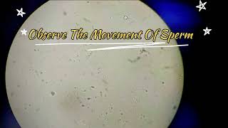 Sperm Under Microscope [upl. by Lavinie]