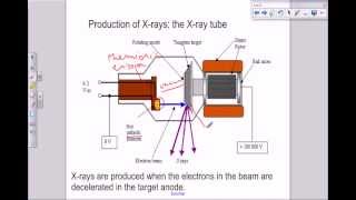 A level Medical Physics  X rays the X ray tube [upl. by Costanza]