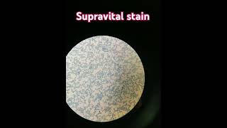 Supra vital stain  For reticulocyte count 💕 [upl. by Ibok206]