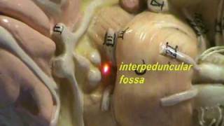 Long Spinal Cord Model  Cranial Nerves I to VI [upl. by Piegari]