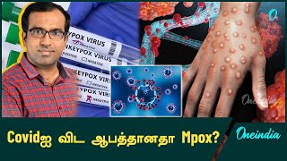 Mpoxல் இருந்து எப்படி தப்பிக்கலாம்  DrFarook Abdullah  Oneindia Tamil [upl. by Schuyler]