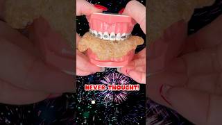 HOW CLOSE to 1 MILLION 🤯 braces 1million crunchy [upl. by Dacey]