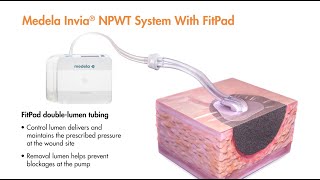 Medela Intelligent Pressure Control and Dynamic Exudate Removal with Captions [upl. by Dynah]