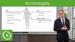 Acromegaly – Endocrinology  Lecturio [upl. by Primaveria]