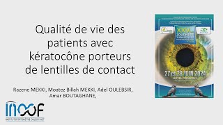 Qualité de vie des patients avec Kératocône porteurs de lentilles de contact [upl. by Skylar]