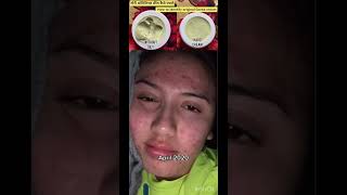 Goree cream  Goree whitening cream  pigmentation cream  dark spots remove cream shortvideo [upl. by Barbey]