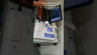 Electrocardiografo Contec con software para PC [upl. by Georgeanna735]