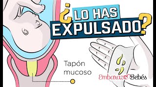 ¿Cuándo debo ir al hospital si he expulsado el tapón mucoso [upl. by Itch]