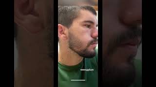 Tratament pentru cresterea barbii🧔🏽‍♂️🔥 dermaroller foryou beardgrowth hairgrowth beard [upl. by Oriaj]