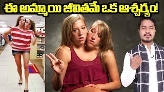 Story of Strange Girls  Conjoined Twins  Abigail amp Brittany Hensel  VikramAditya  EP168 [upl. by Reiter]