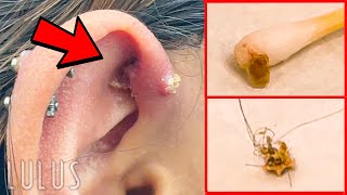 CLEAN Your Piercings Or THIS Can Happen…REMOVAL [upl. by Remle]