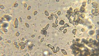 Bacteria and yeast movement microscope video [upl. by Nodnnarb]