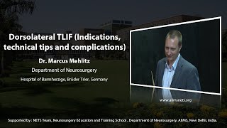 Dorsolateral TLIF indications technical tips and complications [upl. by Asiulairam]