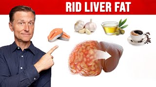 The BEST Foods for a Fatty Liver MUST WATCH [upl. by Ahsinam]