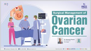 Surgical Treatment for Ovarian Cancer  Ovarian Cancer Awareness [upl. by Griffiths]