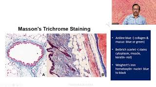 MD DNB Practical CONNECTIVE TISSUE STAINS Massons Trichrome Univ Exam [upl. by Rossie]