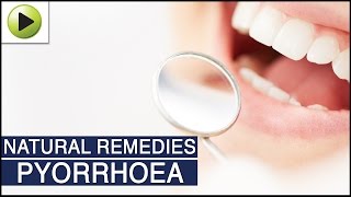 Pyorrhea Pyorrhoea  Natural Ayurvedic Home Remedies [upl. by Eppillihp649]