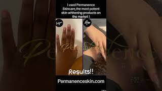 Potent Skin Whitening before and after Permanenceskincom [upl. by Finah]