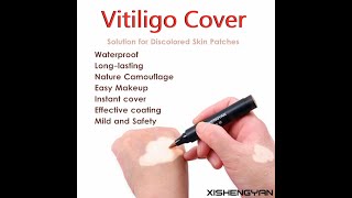 Coverage Waterproof Vitiligo Makeup Concealer Longlasting Camouflage Instant Makeup [upl. by De]