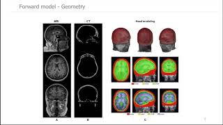 Lecture 1 4 Electrical Source Imaging Pieter van Mierlo [upl. by Prussian]