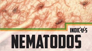 Nematodos Gastrointestinales Sub English [upl. by Youngman960]