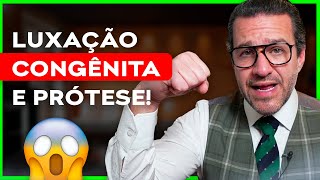 Quem tem LUXAÇÃO CONGÊNITA consegue encaixar a prótese [upl. by Llehsor]