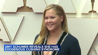 Amy Schumer reveals she has Cushing syndrome [upl. by Eylrahc]