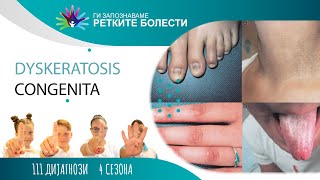 12  Dyskeratosis congenita [upl. by Mima]