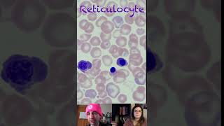 Reticulocyte Morphological Characteristics [upl. by Sylado]