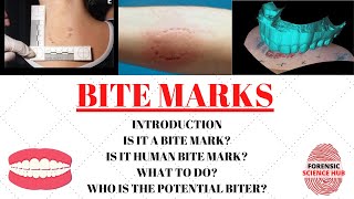 Bite marks  Forensic odontology  UGC NET Forensic science [upl. by Ynaiffit]