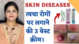 Top 3 Ointments for all Skin Diseases ॥ त्वचा रोगों पर लगाने के बेस्ट 3 क्रीम ॥ [upl. by Sairtemed]