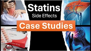 Statin Side Effects Case Studies [upl. by Gayner818]