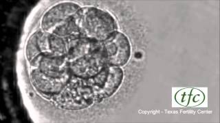 Human Embryo Growing from Fertilization to Day 6 Blastocyst [upl. by Ayat]