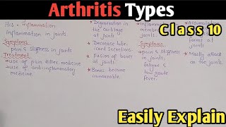 Arthritis  Osteoarthritis  Rheumatoid  Gout  Class 10 Biology UrduHindi [upl. by Hatch]