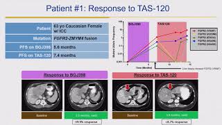 2018 Cholangiocarcinoma Foundation Annual Conference 11  Day 2  FGFR Inhibition [upl. by Greyson]