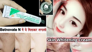 Betnovate–N Cream में ये मिलाकर लगा लो चेहरा बेदाग गोरा होकर हीरे की तरह चमकने लगेगाGlowing Skin [upl. by Adnyc979]