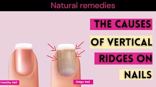 Nail Ridges What Are Your Nails Trying to Tell You [upl. by Rebmak]