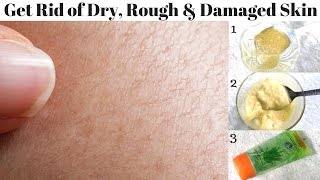 How To Get Rid Of Dry Rough And Damaged Skin Easily At Home  Home Remedies [upl. by Baseler]