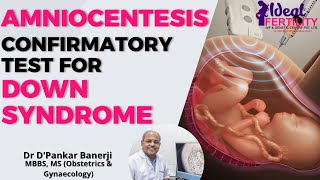 Amniocentesis  Confirmatory Test For DOWN SYNDROME  Dr DPankar Banerji  Ideal Fertility Centre [upl. by Sherburn]