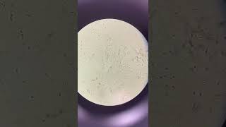 Movimiento de espermatozoides en microscopio de 40x [upl. by Navak]