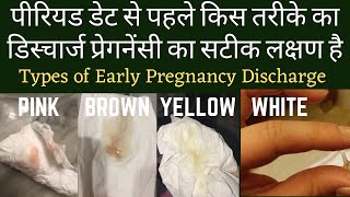 Types of Early Pregnancy Discharge  Early Pregnancy Discharge Symptoms in Hindi [upl. by Bulley535]