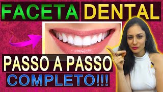 Aula 2  Técnica INFALÍVEL de como fazer uma Faceta Direta em Resina no Consultório 27 [upl. by Pomfret]